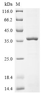 Drosophila melanogaster Protein nanos (nos), partial Recombinant Protein, Drosophila melanogaster (Fruit fly), E.coli, N-terminal 6xHis-KSI-tagged, 36.6 kDa, purity >≥ 90% as determined by SDS-PAGE.