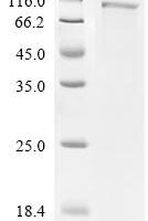 Escherichia coli Isoleucine--tRNA ligase (ileS) Recombinant Protein - BioCrest Sci