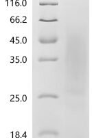 Human Tumor necrosis factor ligand superfamily member 15(TNFSF15) Recombinant Protein - BioCrest Sci