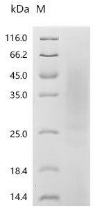 Human Tumor necrosis factor ligand superfamily member 15(TNFSF15) Recombinant Protein, Homo sapiens (Human), Yeast, N-terminal 6xHis-tagged, 23.9 kDa, purity >≥ 85% as determined by SDS-PAGE.