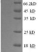 Human Glycogen phosphorylase, brain form (PYGB), partial Recombinant Protein - BioCrest Sci