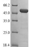 Human Histone-lysine N-methyltransferase SETD7 (SETD7),Partial Recombinant Protein - BioCrest Sci