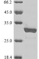 Mycobacterium tuberculosis PP2C-family Ser/Thr phosphatase (pstP), partial Recombinant Protein, N-His - BioCrest Sci
