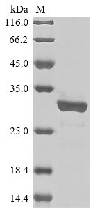 Mycobacterium tuberculosis PP2C-family Ser/Thr phosphatase (pstP), partial Recombinant Protein, N-His, Mycobacterium tuberculosis (strain CDC 1551 / Oshkosh), E.coli, N-terminal 6xHis-tagged, 29.2 kDa, purity >≥ 85% as determined by SDS-PAGE.