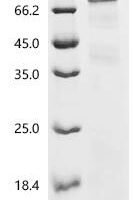 Human Cadherin-18 (CDH18), partial Recombinant Protein - BioCrest Sci