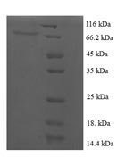 Human papillomavirus type 16 Regulatory protein E2 (E2) Recombinant Protein - BioCrest Sci