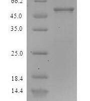 Staphylococcus aureus Clumping factor A (clfA), partial Recombinant Protein - BioCrest Sci