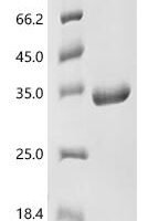 Human Ras GTPase-activating-like protein IQGAP1 (IQGAP1), partial Recombinant Protein - BioCrest Sci