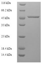 Human F-actin-capping protein subunit alpha-2 (CAPZA2) Recombinant Protein, Homo sapiens (Human), E.coli, N-terminal 6xHis-SUMO-tagged, 48.8 kDa, purity >≥ 90% as determined by SDS-PAGE.
