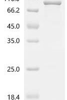 Human Prolyl 3-hydroxylase 1 (P3H1) Recombinant Protein - BioCrest Sci