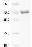 Rhizomucor miehei Lipase Recombinant Protein - BioCrest Sci