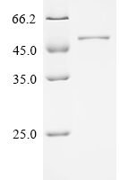 Pseudomonas aeruginosa Outer membrane porin F (oprF) Recombinant Protein - BioCrest Sci