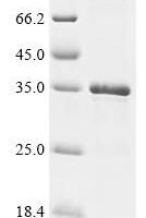 Human Cancer/testis antigen 2(CTAG2) Recombinant Protein - BioCrest Sci