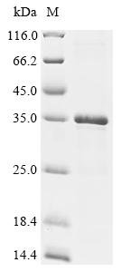 Human Cancer/testis antigen 2(CTAG2) Recombinant Protein, Homo sapiens (Human), E.coli, N-terminal 6xHis-tagged, 28.0 kDa, purity >≥ 85% as determined by SDS-PAGE.