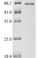 Human Transcriptional regulator ERG (ERG) Recombinant Protein, C-His - BioCrest Sci