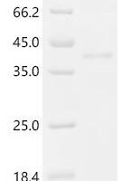 Macaca fascicularis Inhibin subunit beta E (INHBE), partial Recombinant Protein, N-hFc - BioCrest Sci