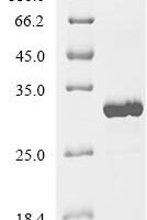 Escherichia coli Ribosome-recycling factor (frr) Recombinant Protein - BioCrest Sci