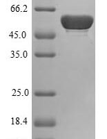 Human Bisphosphoglycerate mutase (BPGM) Recombinant Protein - BioCrest Sci