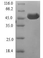 Human B9 domain-containing protein 2 (B9D2) Recombinant Protein - BioCrest Sci