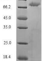 Human Toll-like receptor 2 (TLR2), partial Recombinant Protein - BioCrest Sci