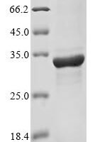 Toxoplasma gondii Dense granule protein 2 (GRA2) Recombinant Protein - BioCrest Sci
