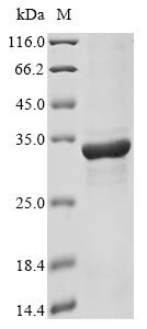 Toxoplasma gondii Dense granule protein 2 (GRA2) Recombinant Protein, Toxoplasma gondii, E.coli, N-terminal 10xHis-tagged and C-terminal Myc-tagged, 25.0 kDa, purity >≥ 85% as determined by SDS-PAGE.