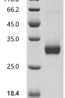Human Tumor necrosis factor ligand superfamily member 4 (TNFSF4), partial Recombinant Protein - BioCrest Sci