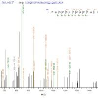 Human Histone deacetylase 4 (HDAC4), partial Recombinant Protein - BioCrest Sci