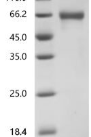 Human Furin (FURIN), partial Recombinant Protein - BioCrest Sci
