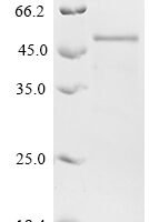 Human Collagen alpha-1 (XI) chain (COL11A1), partial Recombinant Protein, N-His-GST - BioCrest Sci
