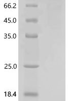 Human Selenoprotein P (SELENOP), Biotinylated Recombinant Protein - BioCrest Sci