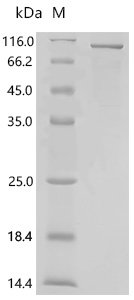 Human Selenoprotein P (SELENOP), Biotinylated Recombinant Protein, E.coli, N-terminal MBP-tagged and C-terminal 6xHis-Avi-tagged, 88.3 kDa, purity >≥ 85% as determined by SDS-PAGE.
