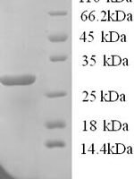 Human Potassium-transporting ATPase subunit beta (ATP4B), partial Recombinant Protein, N-His - BioCrest Sci