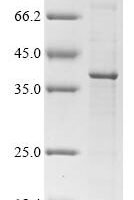 Rat Cathepsin Z(Ctsz) Recombinant Protein - BioCrest Sci