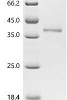 Human Solute carrier family 45 member 3 (SLC45A3)，partial Recombinant Protein - BioCrest Sci