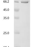 Bovine pro-epidermal growth factor (EGF), partial Recombinant Protein, N-His-NusA - BioCrest Sci