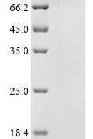 Gnathostoma spinigerum Matrix metalloproteinase-like protein Recombinant Protein - BioCrest Sci