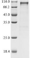 Human 2-5A-dependent ribonuclease (RNASEL) Recombinant Protein, N-GST - BioCrest Sci