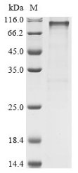 Human 2-5A-dependent ribonuclease (RNASEL) Recombinant Protein, N-GST, Homo sapiens (Human), E.coli, N-terminal GST-tagged, 111.0 kDa, purity >≥ 85% as determined by SDS-PAGE.
