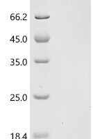 Anguilla japonica Ventricular natriuretic peptide (vnp) Recombinant Protein, C-His, aa 115–150, E.coli - BioCrest Sci