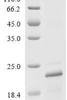 Human Sodium channel protein type 1 subunit alpha (SCN1A), partial Recombinant Protein, C-His - BioCrest Sci