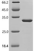 Horse Ferritin light chain (FTL) Recombinant Protein - BioCrest Sci
