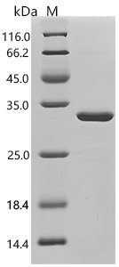 Horse Ferritin light chain (FTL) Recombinant Protein, Equus caballus (Horse), E.coli, C-terminal 10xHis-tagged, 29.6 kDa, purity >≥ 85% as determined by SDS-PAGE.