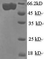 Shigella flexneri serotype X E3 ubiquitin-protein ligase ipaH9.8 (ipaH9.8) Recombinant Protein, N-His, aa 1–545, E.coli - BioCrest Sci