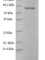 Human Keratin, type II cytoskeletal 6A (KRT6A) Recombinant Protein, N-His - BioCrest Sci