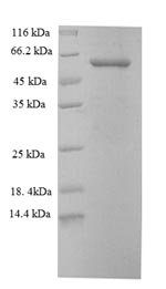 Human Keratin, type II cytoskeletal 6A (KRT6A) Recombinant Protein, N-His, Homo sapiens (Human), E.coli, N-terminal 6xHis-tagged, 63.9 kDa, purity >≥ 90% as determined by SDS-PAGE.
