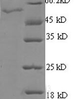 Human StAR-related lipid transfer protein 7, mitochondrial (STARD7), partial Recombinant Protein - BioCrest Sci
