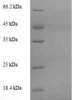 Oncorhynchus mykiss Myelin proteolipid protein (plp), partial Recombinant Protein - BioCrest Sci