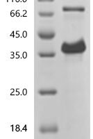 Streptococcus sp. group G Immunoglobulin G-binding protein G (spg), partial Recombinant Protein, N-His, aa 291–497, Purity ≥95% - BioCrest Sci