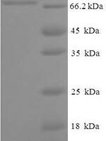 Human ATP-dependent RNA helicase A (DHX9), partial Recombinant Protein, N-His-SUMO - BioCrest Sci